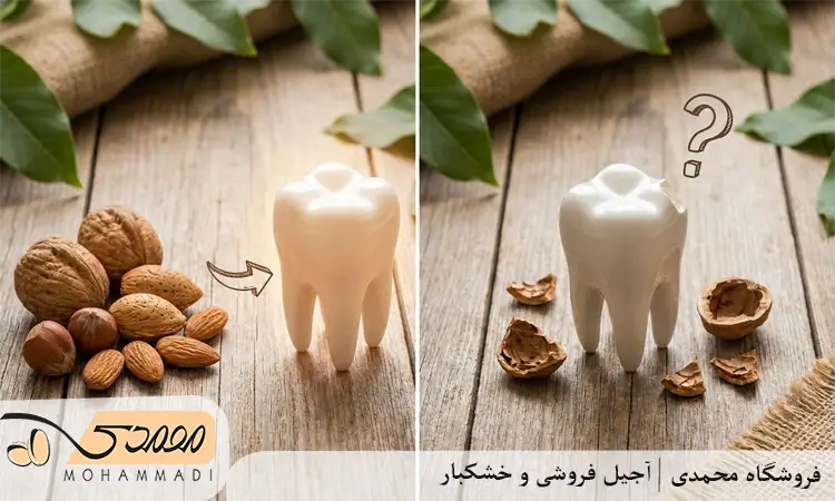 آجیل برای دندان